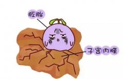 因为内膜粘连到泰国做试管成功率高吗？