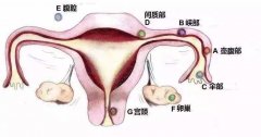 泰国试管婴儿能预防异位妊娠吗？