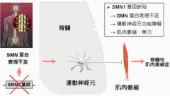 脊肌萎缩携带者能做泰国三代试管吗？