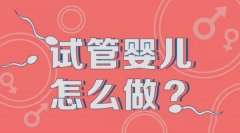 试管婴儿的过程：取卵取精操作细则